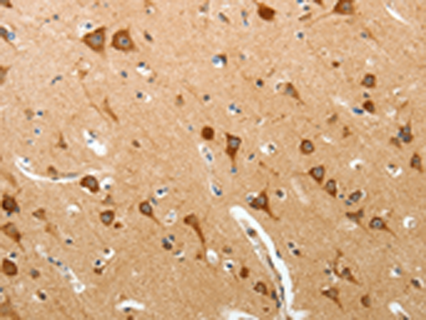 Rabbit Polyclonal Antibody to BIRC6