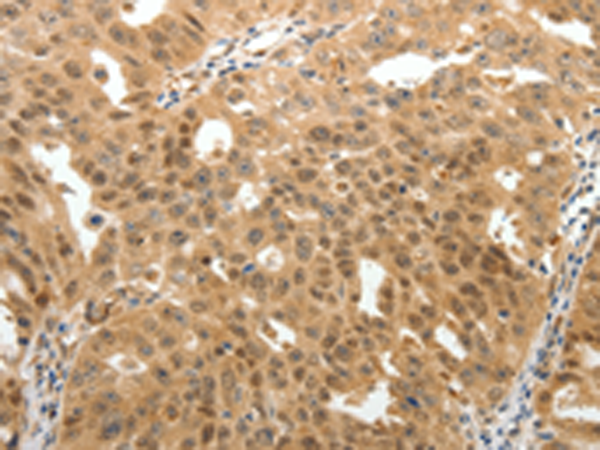 Rabbit Polyclonal Antibody to MAP1A