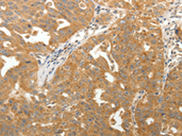 Rabbit Polyclonal Antibody to MAP1B
