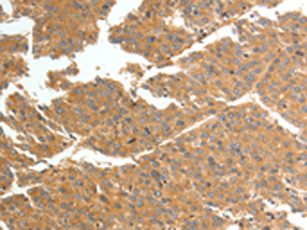 Rabbit Polyclonal Antibody to TNN