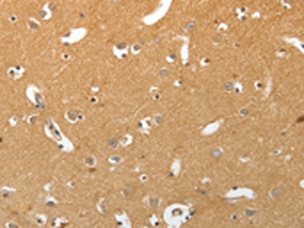 Rabbit Polyclonal Antibody to TNR