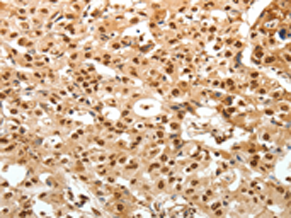 Rabbit Polyclonal Antibody to TNXB