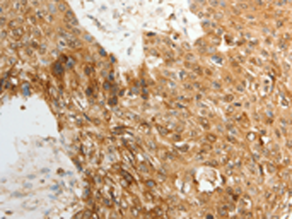 Rabbit Polyclonal Antibody to TENM3