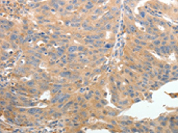 Rabbit Polyclonal Antibody to TERT