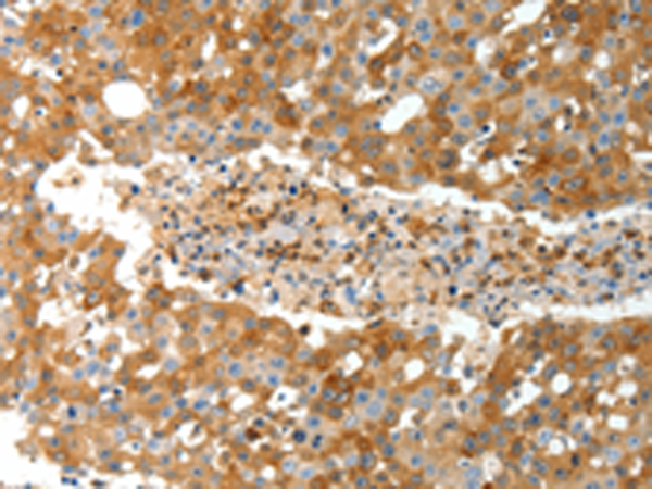 Rabbit Polyclonal Antibody to TEP1