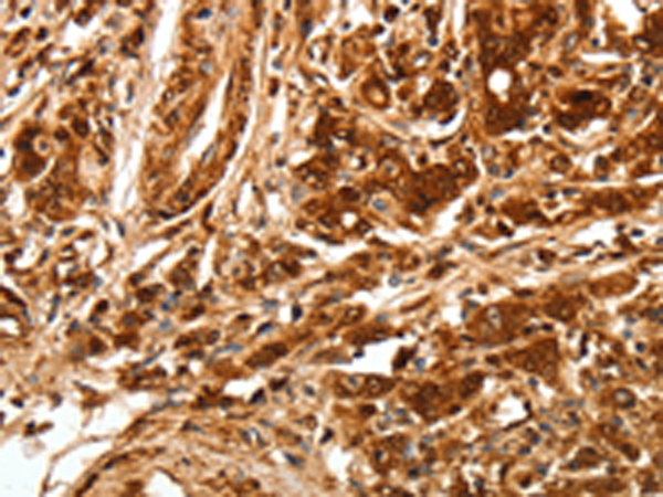 Rabbit Polyclonal Antibody to TGFBR1