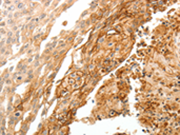 Rabbit Polyclonal Antibody to TGM1
