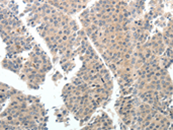 Rabbit Polyclonal Antibody to TEK