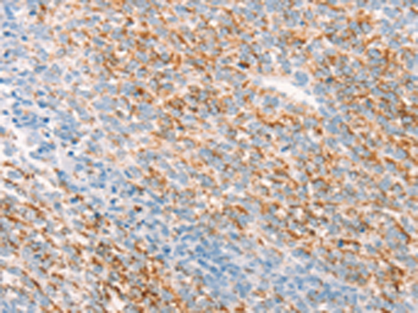 Rabbit Polyclonal Antibody to THY1