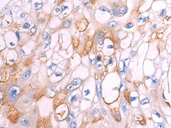 Rabbit Polyclonal Antibody to CD93