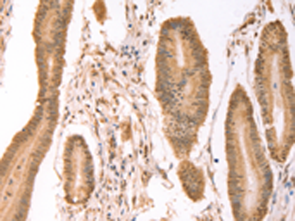 Rabbit Polyclonal Antibody to PTMA