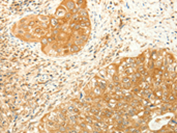 Rabbit Polyclonal Antibody to RARRES1