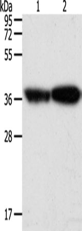Rabbit Polyclonal Antibody to TPM2