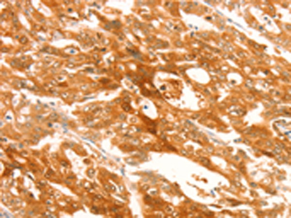 Rabbit Polyclonal Antibody to TRPM7