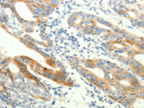 Rabbit Polyclonal Antibody to TRPA1