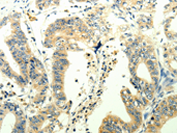 Rabbit Polyclonal Antibody to TRPM7