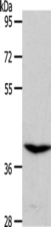 Rabbit Polyclonal Antibody to S1PR4