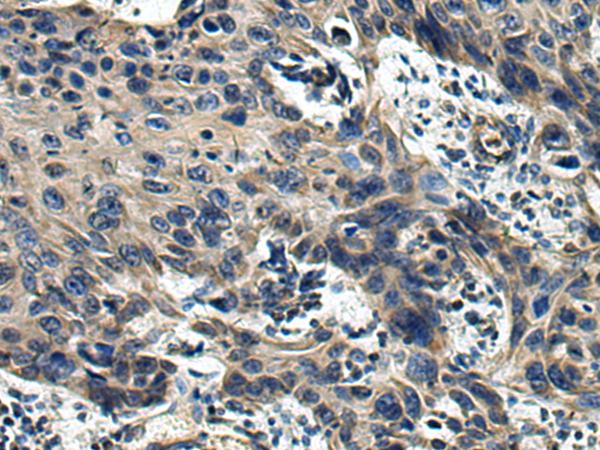 Rabbit Polyclonal Antibody to S1PR2