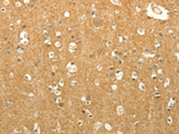 Rabbit Polyclonal Antibody to LPAR3