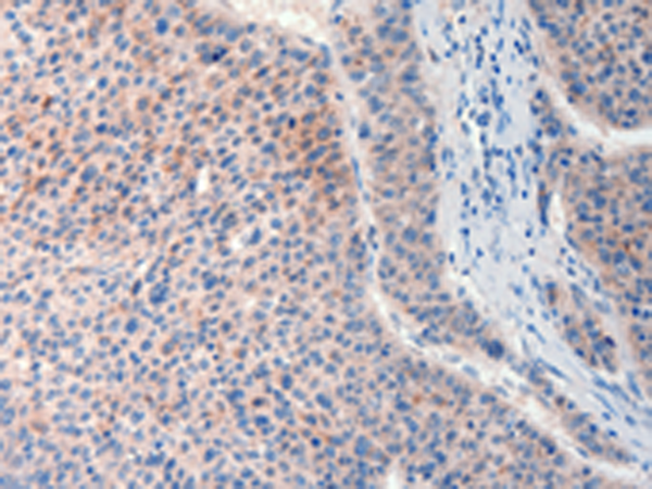 Rabbit Polyclonal Antibody to FAT4