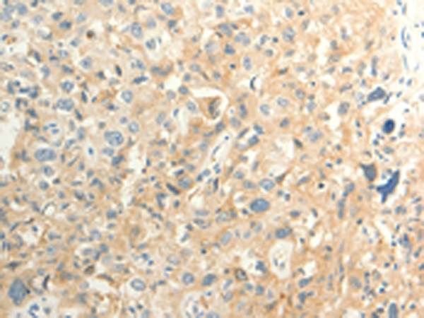 Rabbit Polyclonal Antibody to FAT3