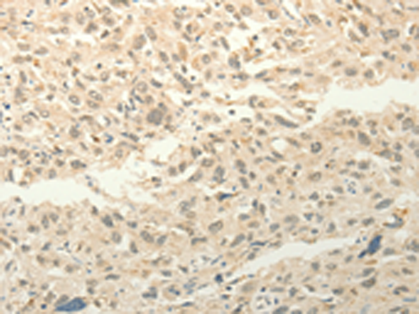 Rabbit Polyclonal Antibody to FZD8