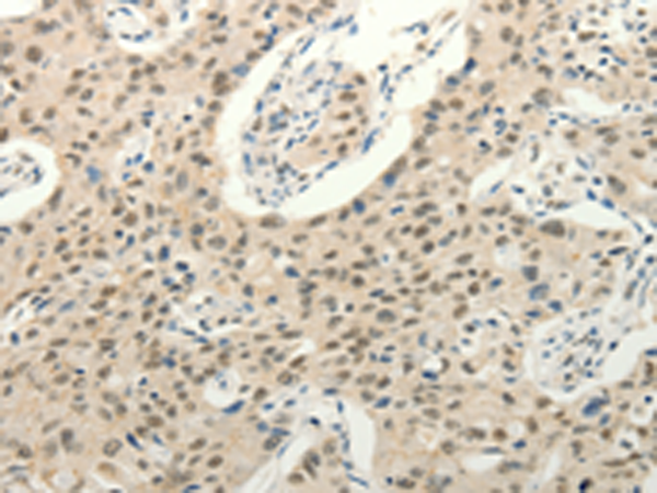 Rabbit Polyclonal Antibody to FZD10