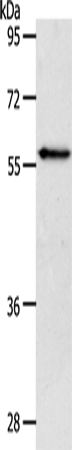 Rabbit Polyclonal Antibody to VANGL2