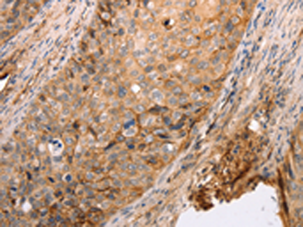 Rabbit Polyclonal Antibody to pan CDH