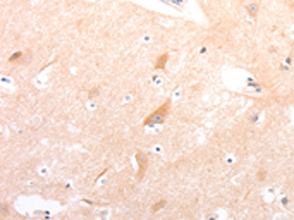 Rabbit Polyclonal Antibody to CELSR2