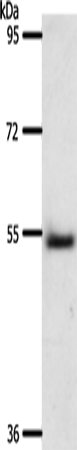Rabbit Polyclonal Antibody to A1BG