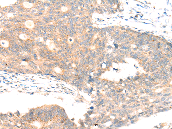 Rabbit Polyclonal Antibody to ABCA10