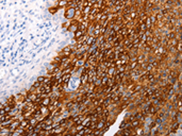 Rabbit Polyclonal Antibody to ABCA4