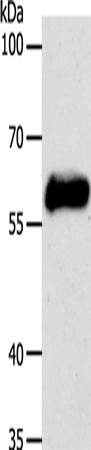 Rabbit Polyclonal Antibody to KRT10