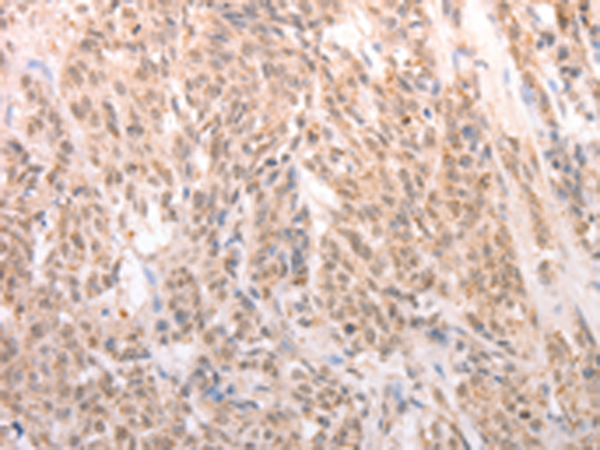 Rabbit Polyclonal Antibody to ACIN1