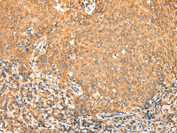 Rabbit Polyclonal Antibody to TADA2A