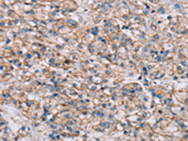 Rabbit Polyclonal Antibody to ADAM12