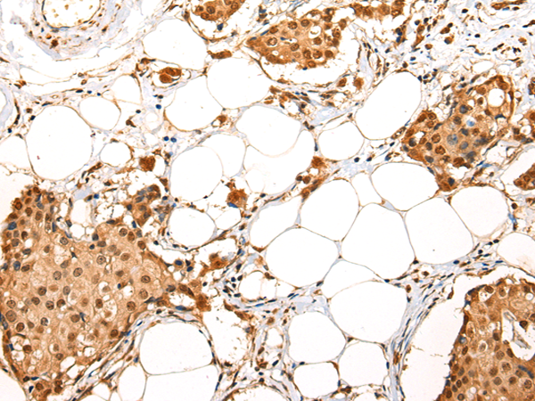 Rabbit Polyclonal Antibody to ADAM19