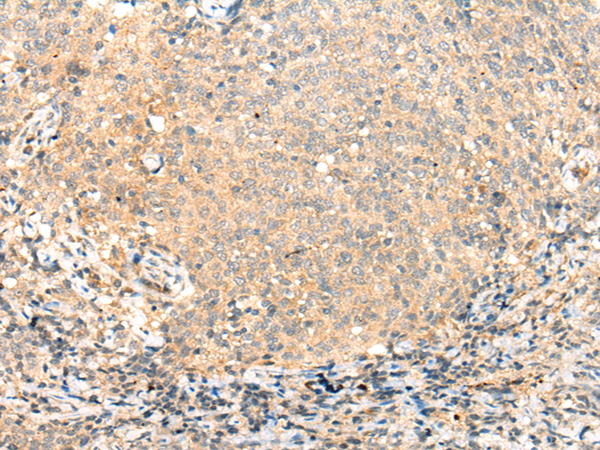 Rabbit Polyclonal Antibody to ADAMTS13