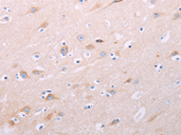 Rabbit Polyclonal Antibody to ADCY5