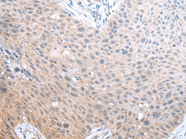 Rabbit Polyclonal Antibody to ADORA1