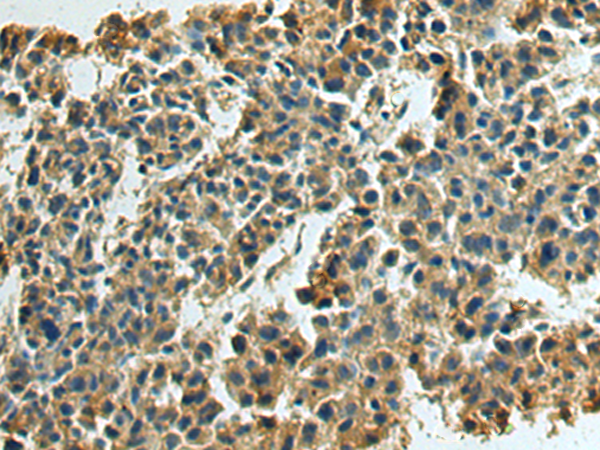 Rabbit Polyclonal Antibody to ADORA2A