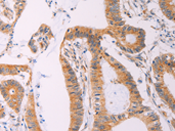 Rabbit Polyclonal Antibody to ADCY1