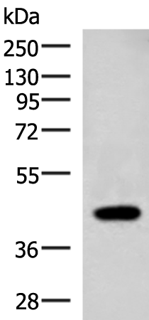 Rabbit Polyclonal Antibody to ADH1B
