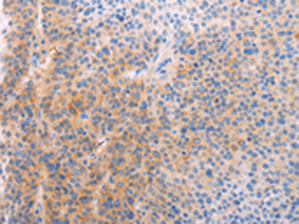 Rabbit Polyclonal Antibody to ADHFE1