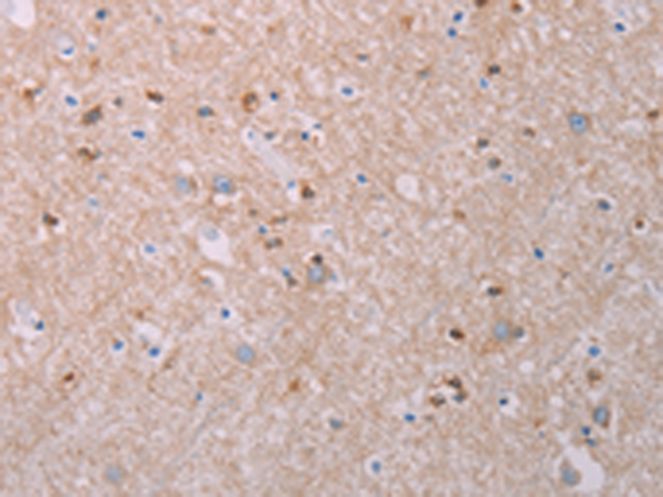 Rabbit Polyclonal Antibody to AKT2