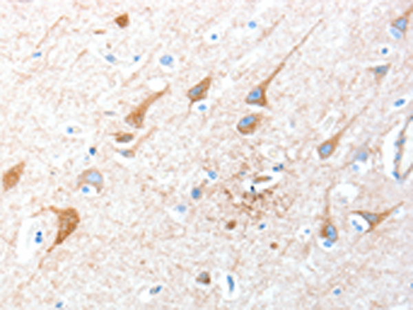 Rabbit Polyclonal Antibody to AKT3