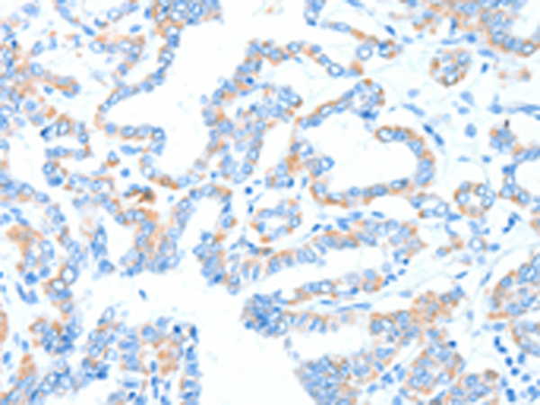 Rabbit Polyclonal Antibody to GPT