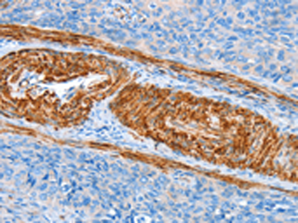 Rabbit Polyclonal Antibody to AARS1