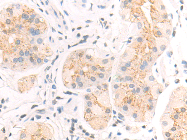 Rabbit Polyclonal Antibody to ALDH1B1